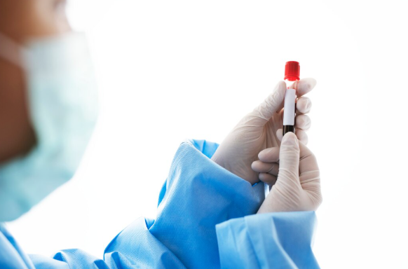 Exames de Sangue: Essenciais para Saúde e Bem-Estar